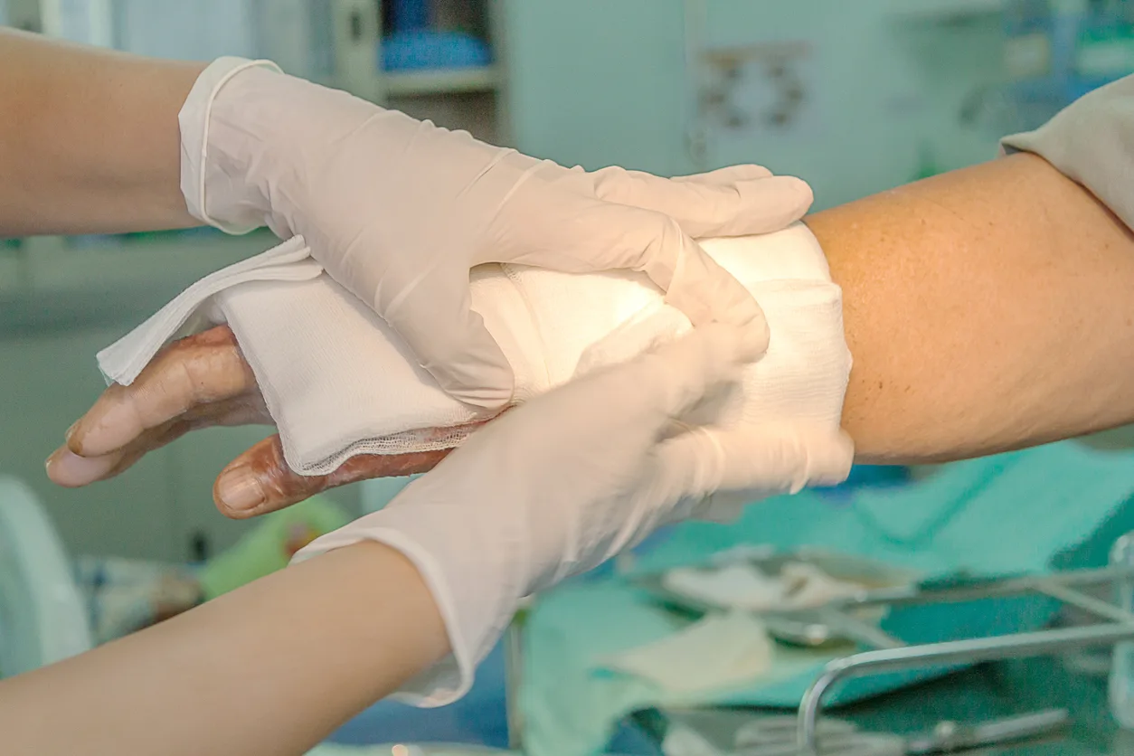 Burn Injuries from Truck Accidents in Houston, TX