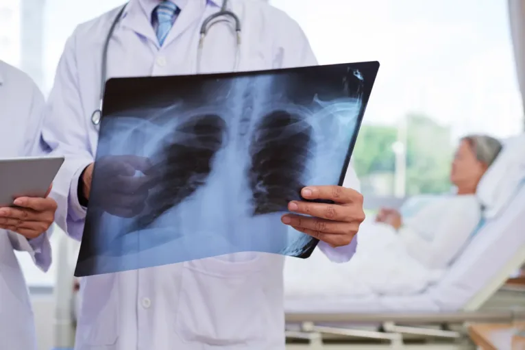 Chest Injuries After a Car Accident in Houston