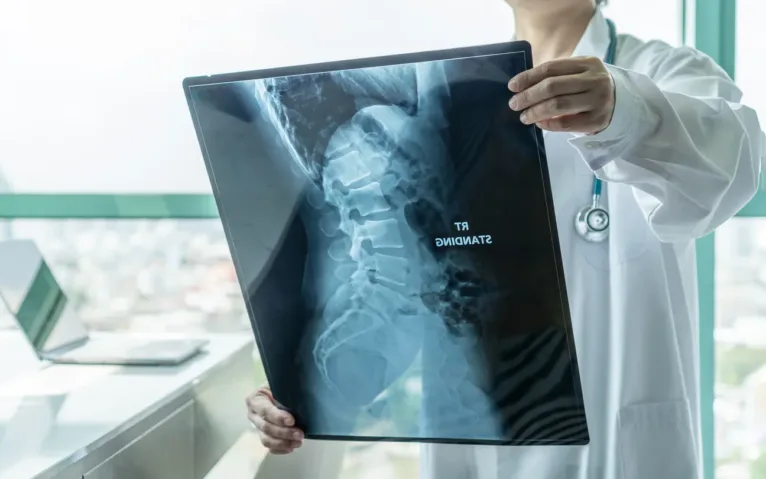 Fracturas óseas