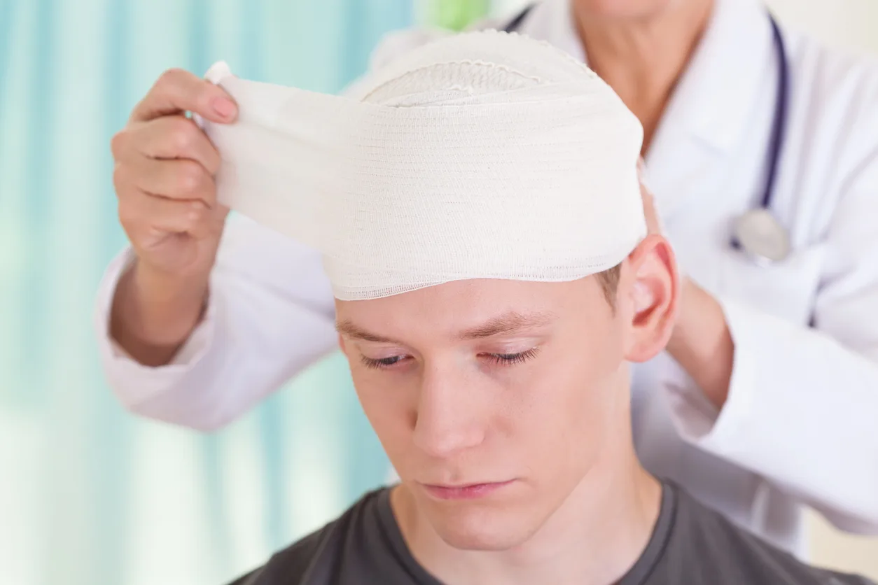 What You Need To Know About Contrecoup Injury